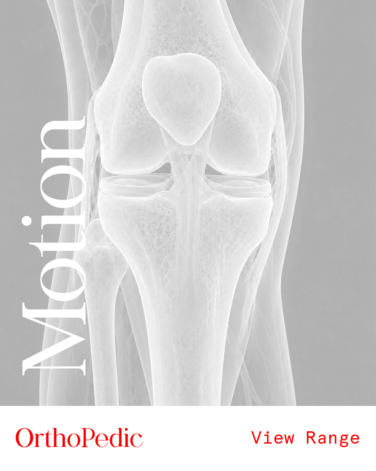 Orthopedic Instruments
